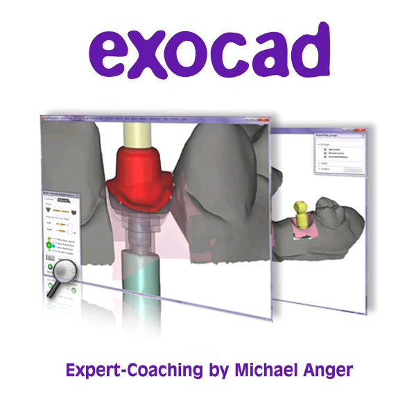 EXOCAD - Experten Seminar - Framework & Teleskope