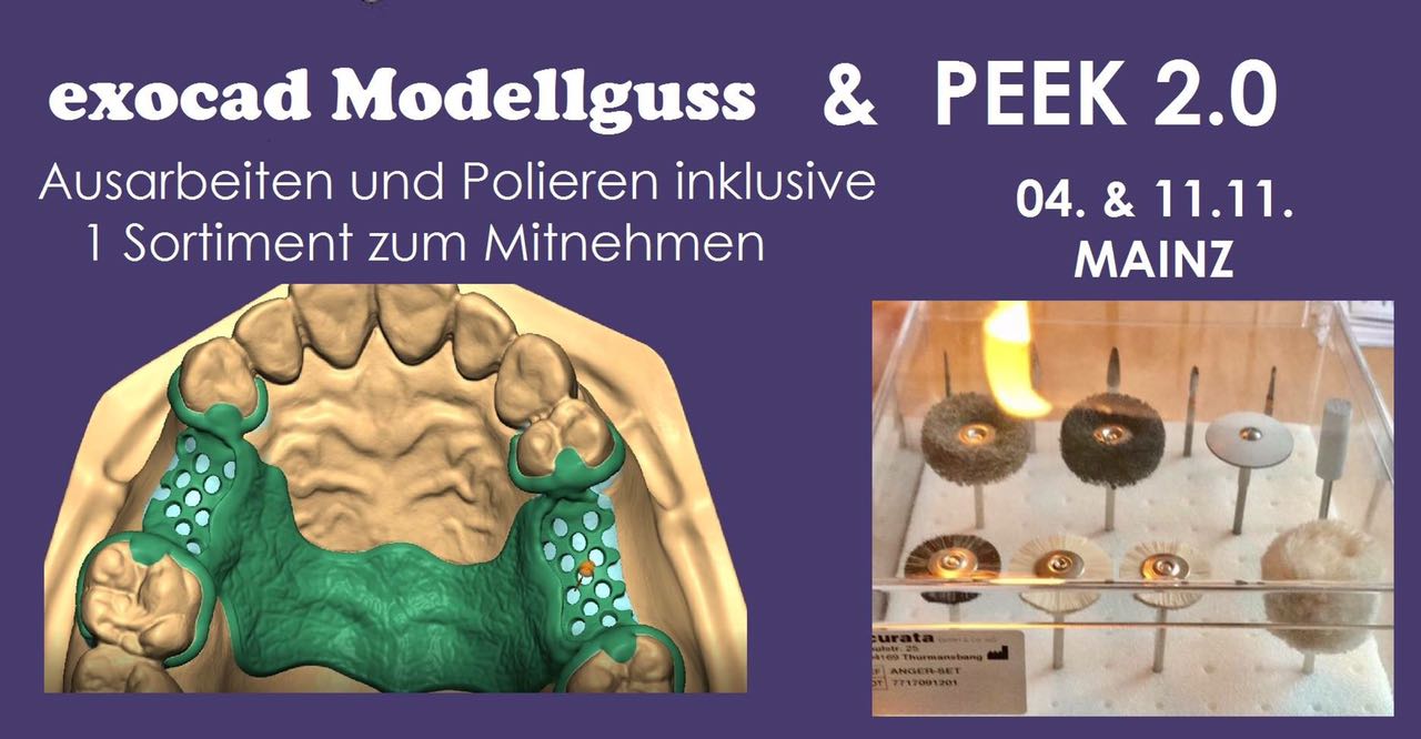 Exocad Modellguss & PEEK 2.0  by Michael Anger