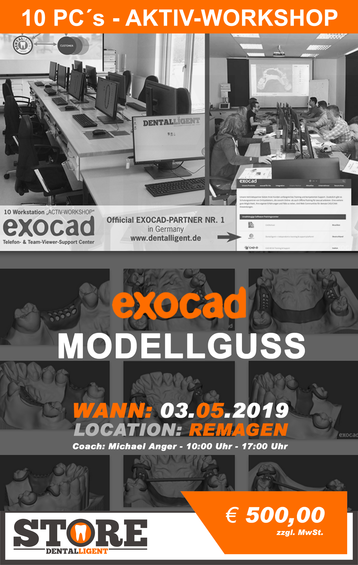 Exocad-Modellguss  by Michael Anger - 10 PC´s AKTIV WORKSHOP - in REMAGEN