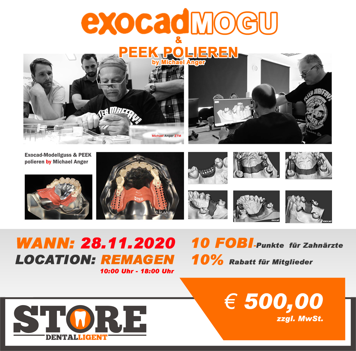 Exocad-Modellguss & PEEK polieren by Michael Anger