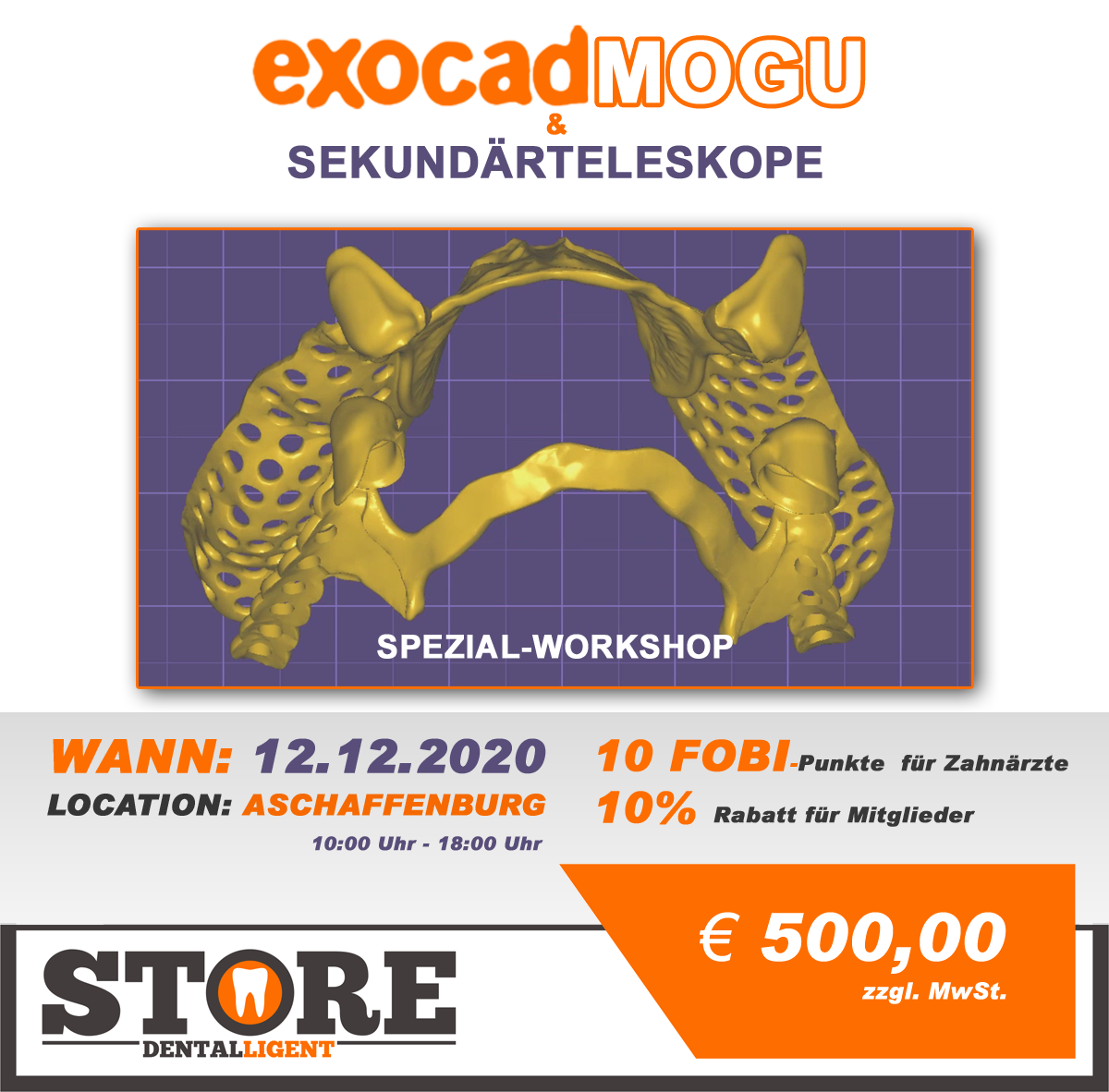 Exocad-Modellguss & Sekundärteleskope - SPEZIAL-WORKSHOP