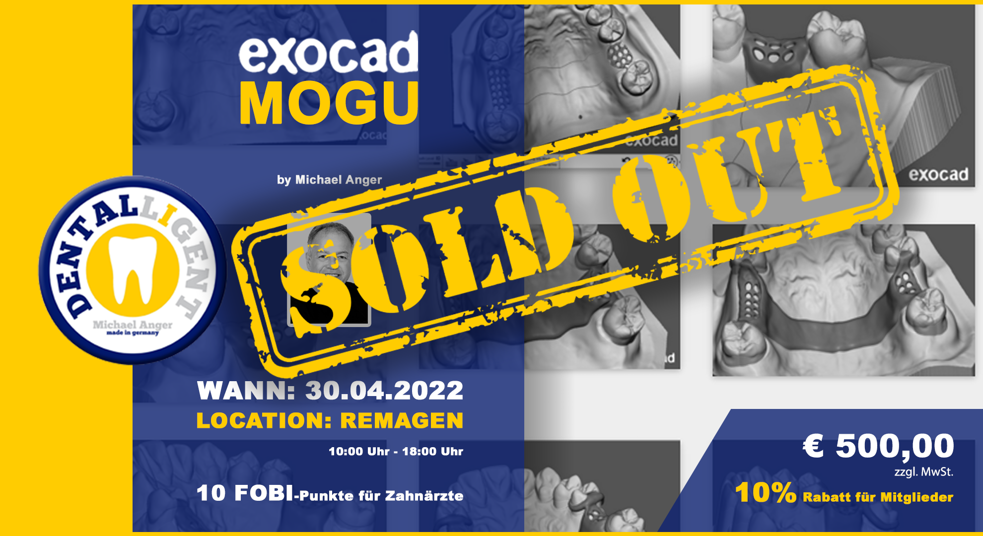 Exocad-Modellguss  by Michael Anger - 10 PC´s AKTIV WORKSHOP