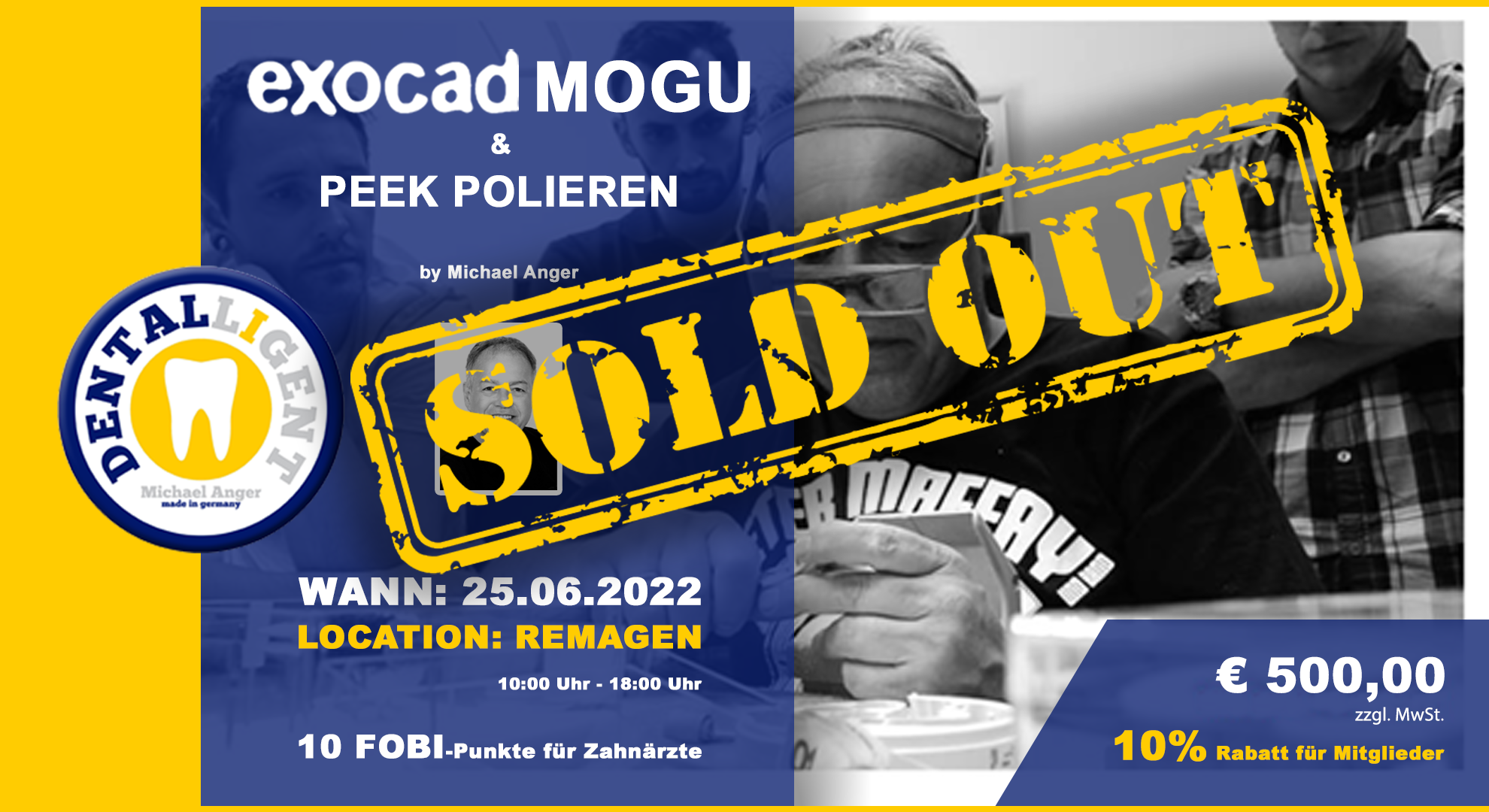 AUSVERKAUFT - Exocad-Modellguss & PEEK polieren by Michael Anger in Remagen