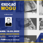 Exocad-Modellguss  by Michael Anger - 10 PC´s AKTIV WORKSHOP