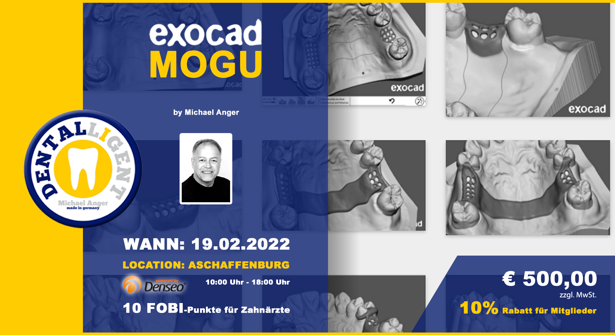 Exocad-Modellguss  by Michael Anger - 10 PC´s AKTIV WORKSHOP