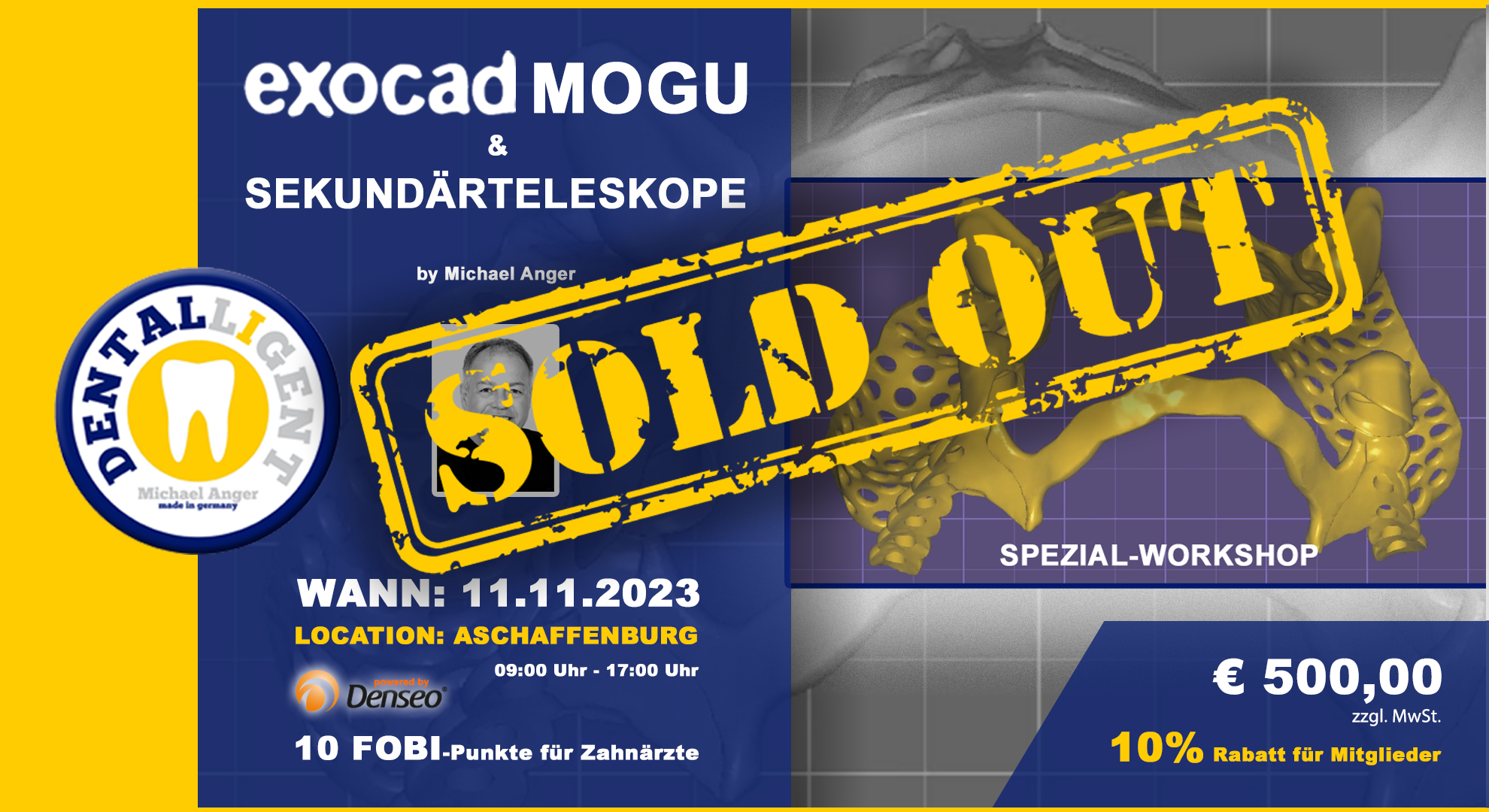 AUSVERKAUFT! - Exocad-Modellguss & Sekundärteleskope - SPEZIAL-WORKSHOP