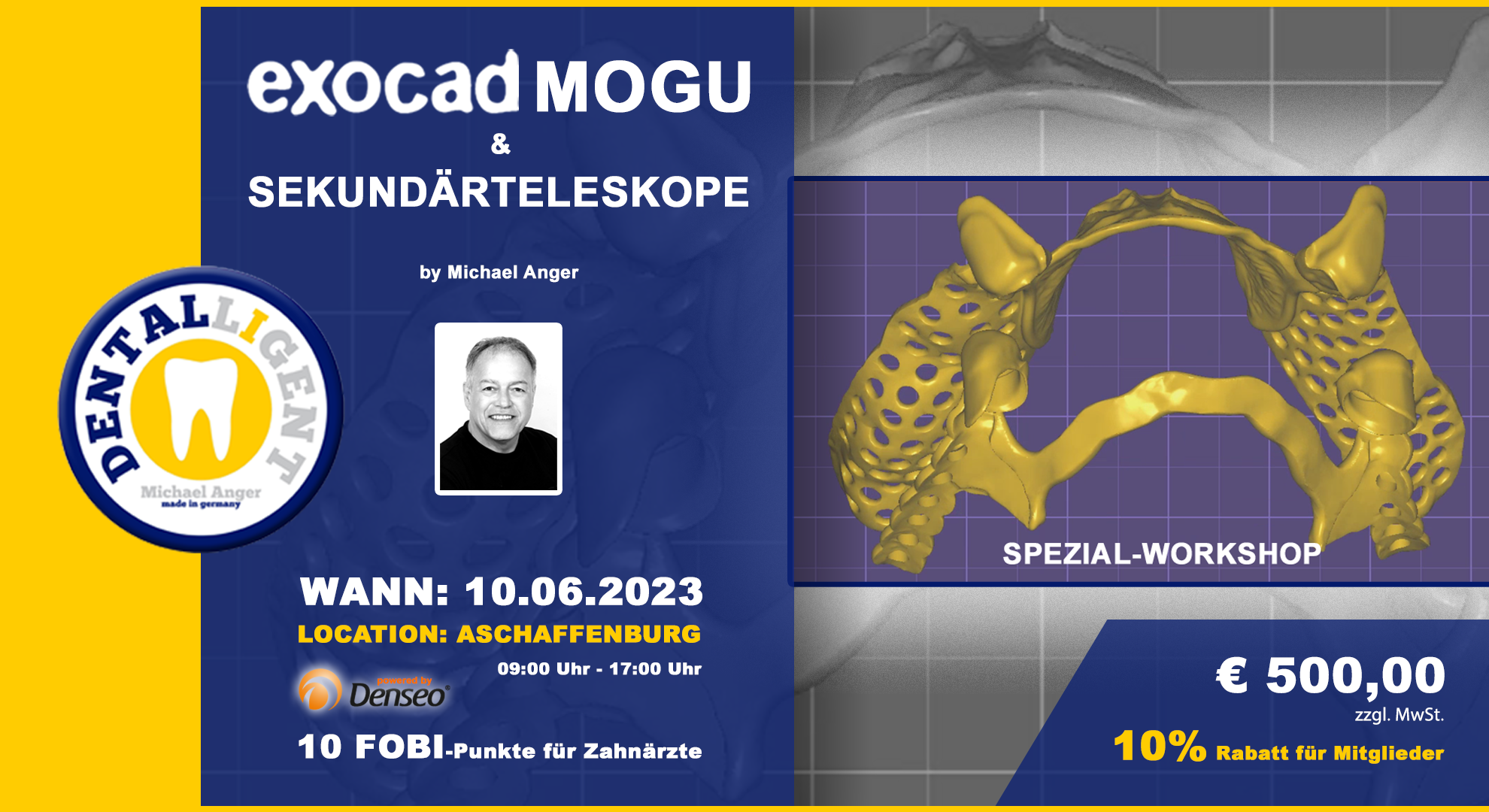 Exocad-Modellguss & Sekundärteleskope - SPEZIAL-WORKSHOP