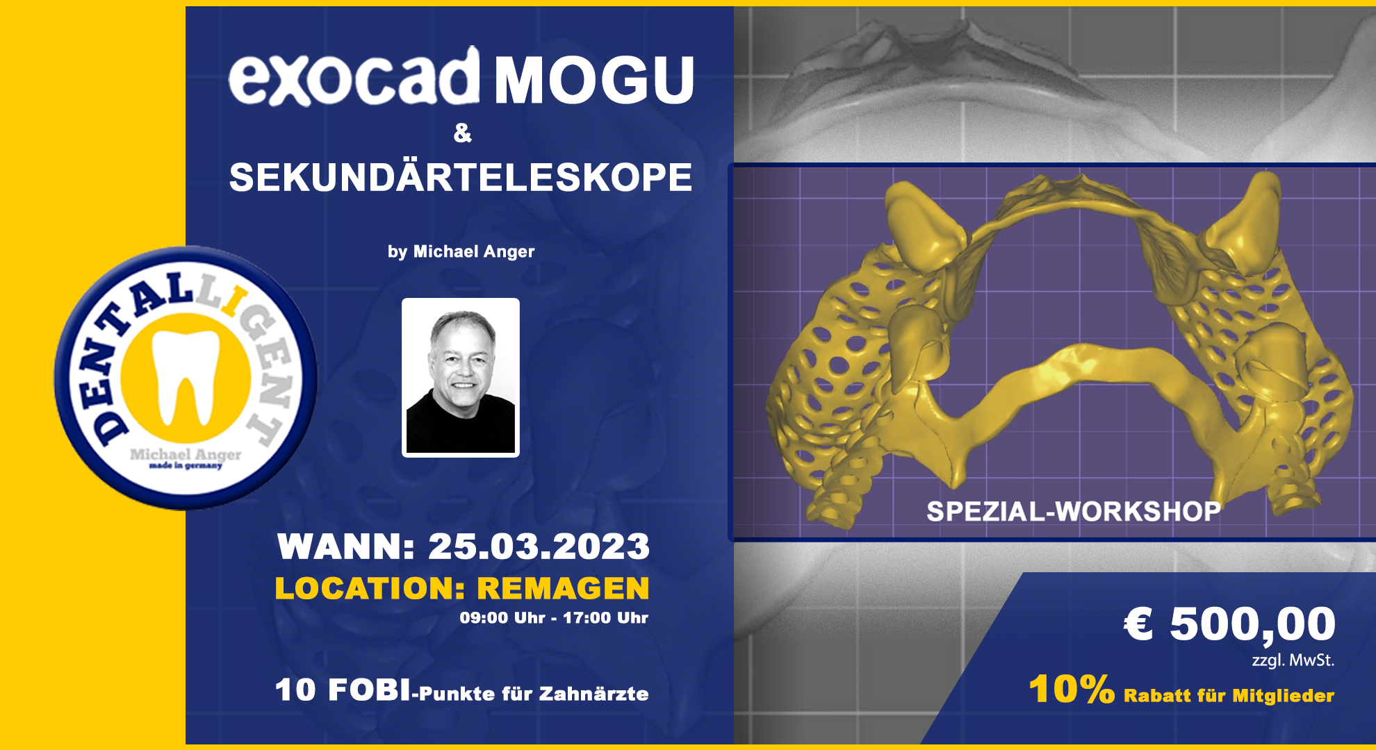 Exocad-Modellguss & Sekundärteleskope - SPEZIAL-WORKSHOP