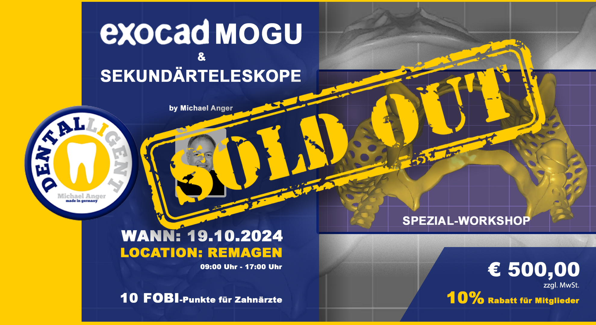 AUSVERKAUFT ! Exocad-Modellguss & Sekundärteleskope - SPEZIAL-WORKSHOP