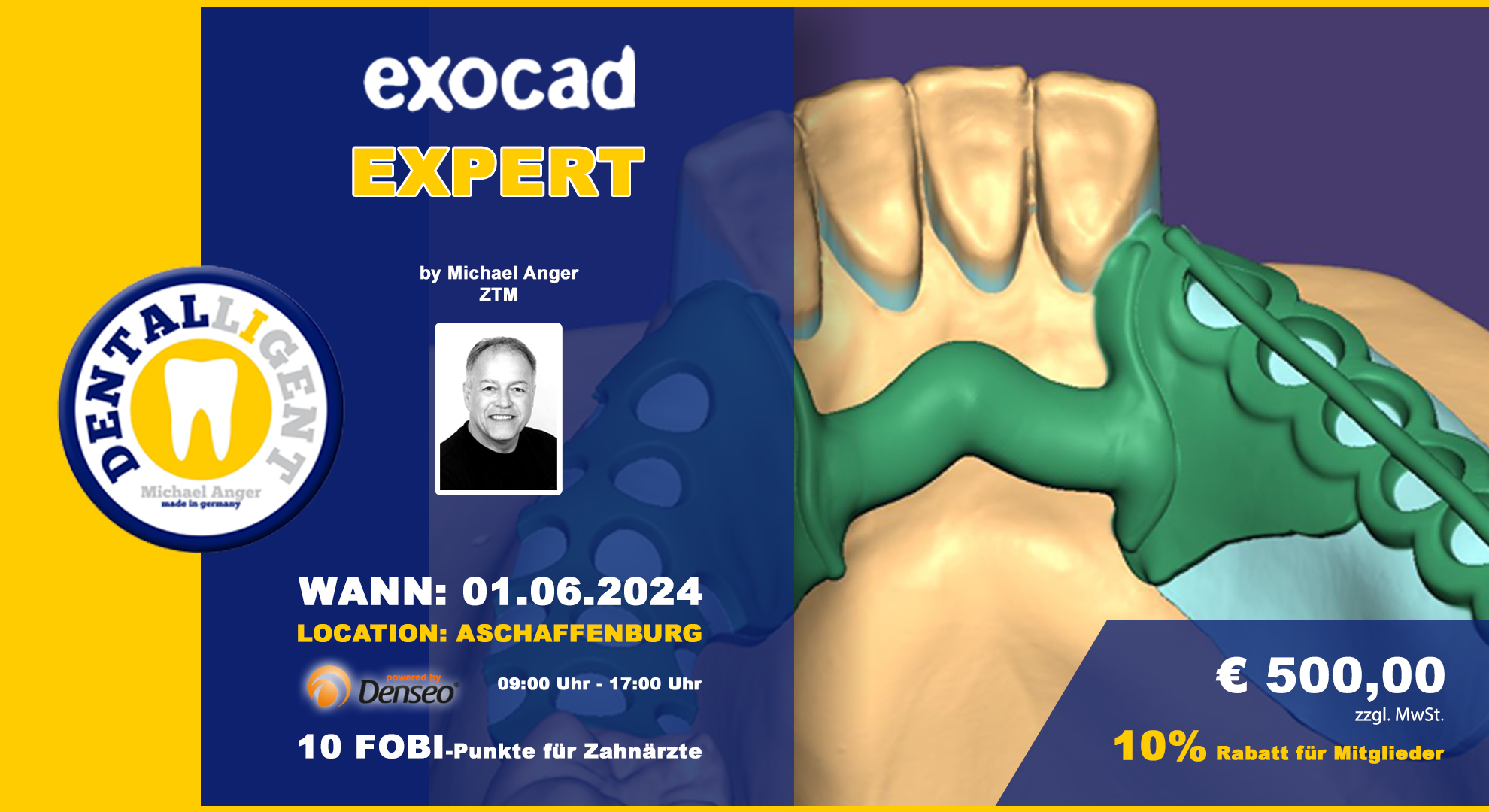 EXOCAD - EXPERT - "AKTIV WORKSHOP" bei DENSEO GmbH