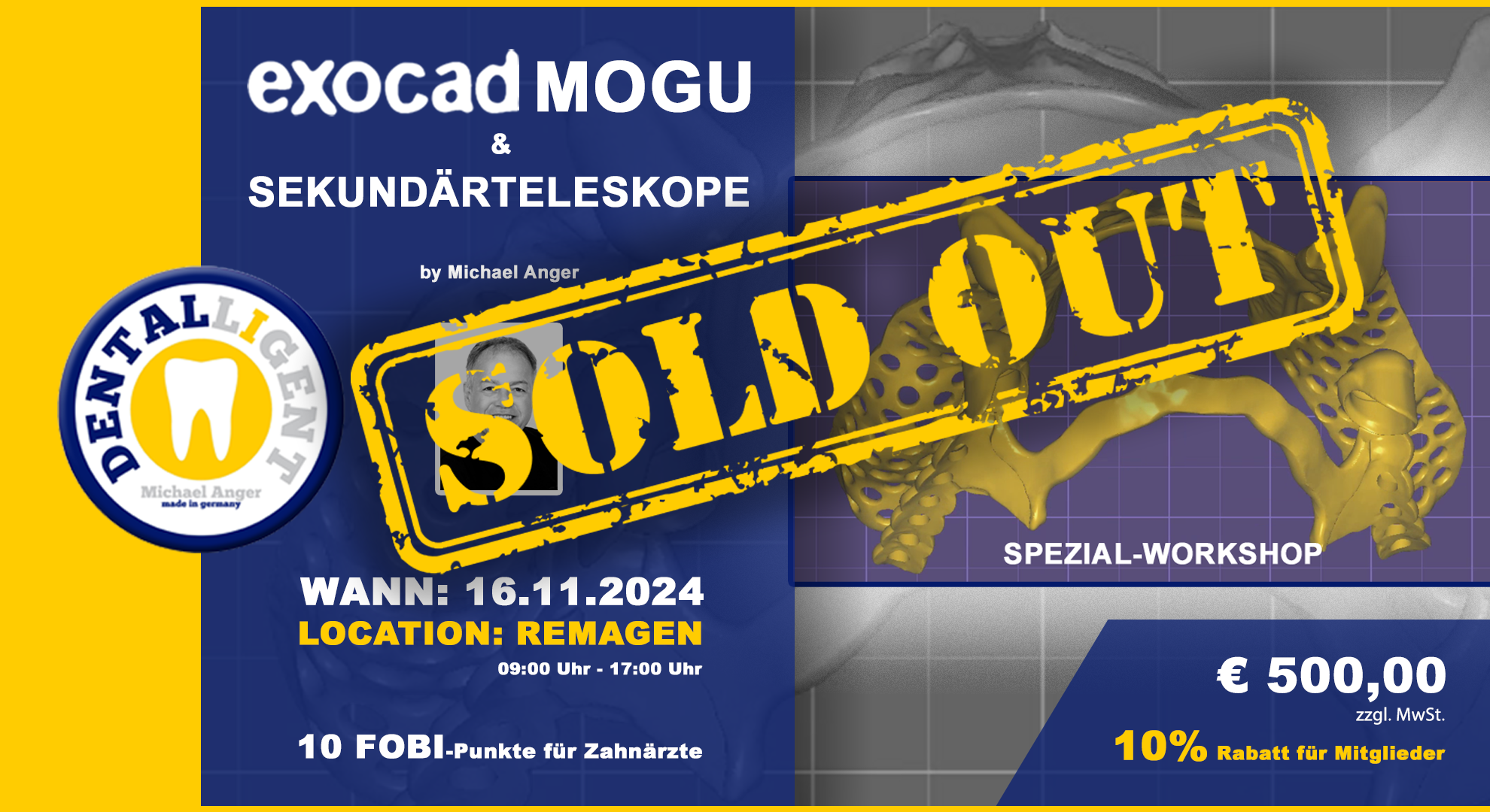 AUSVERKAUFT ! - Exocad-Modellguss & Sekundärteleskope - SPEZIAL-WORKSHOP in Remagen